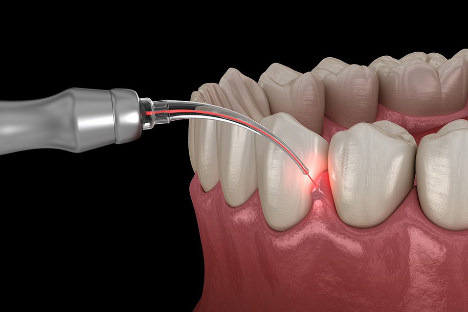 DENTISTERIE GÉNÉRALE, URGENCES DENTAIRES